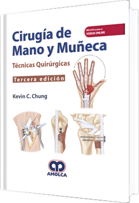 Cirugia De Mano Y Muñeca Tecnicas Quirurgicas