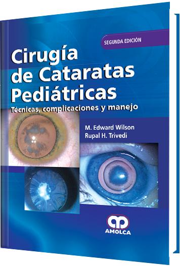 Cirugía de Cataratas Pediátricas – Técnicas, complicaciones y manejo – Segunda edición-UNIVERSAL BOOKS-UNIVERSAL BOOKS
