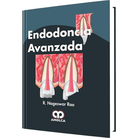 Endodoncia Avanzada-amolca-UNIVERSAL BOOKS