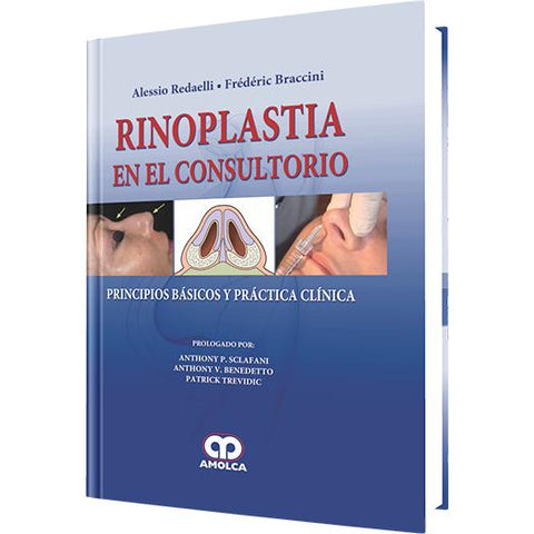 Rinoplastia en el Consultorio Principios Basicos y Practica Clinica-REVISION - 27/01-amolca-UNIVERSAL BOOKS