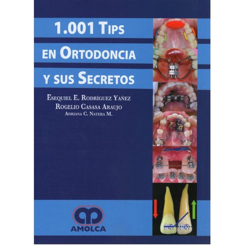 1001 Tips en Ortodoncia-amolca-UNIVERSAL BOOKS