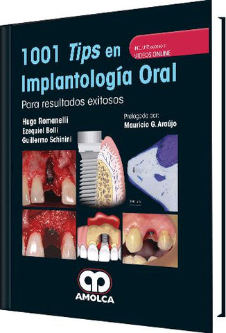 1001 Tips en Implantología Oral-UNIVERSAL BOOKS-UNIVERSAL BOOKS