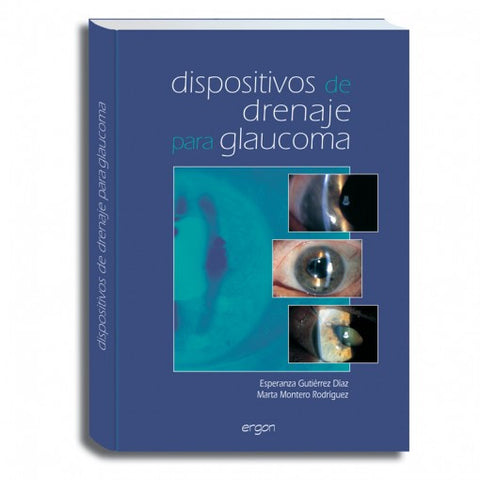 Dispositivos de Drenaje para Glaucoma-ergon-UNIVERSAL BOOKS