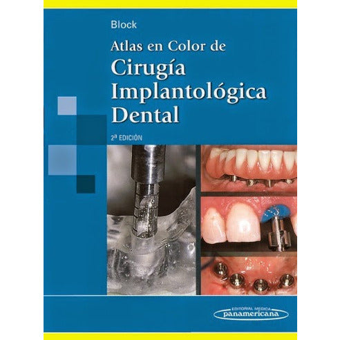 Atlas en Color de Cirugia Implantologica Dental-panamericana-UNIVERSAL BOOKS