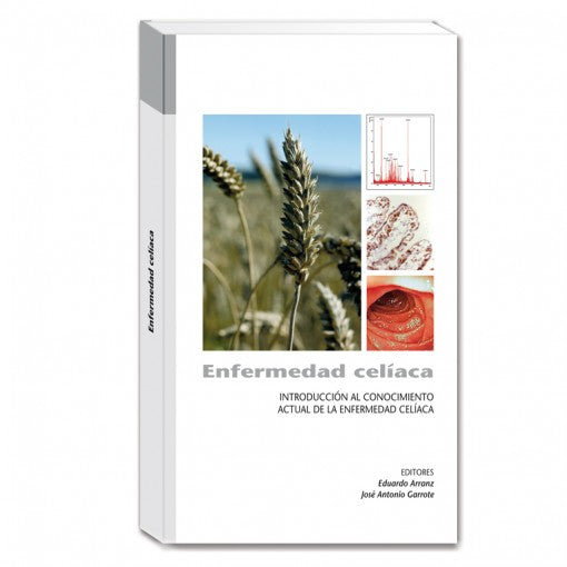 Enfermedad celiaca. Introduccion al conocimiento actual de la enfermedad celiaca - 2da edicion-ergon-UNIVERSAL BOOKS