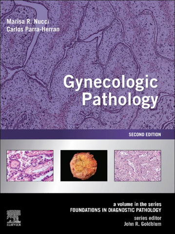 Gynecologic Pathology E-Book (ebook)
