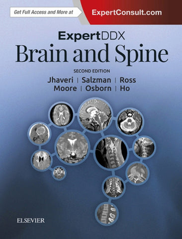 ExpertDDx: Brain and Spine E-Book (ebook)