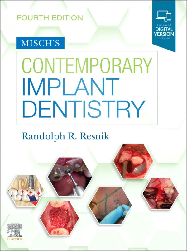 Misch's Contemporary Implant Dentistry E-Book (ebook)