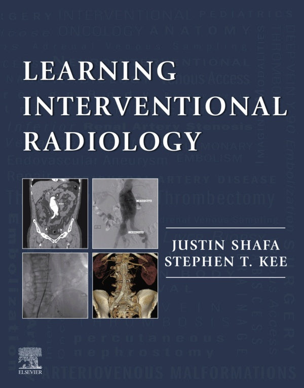 Learning Interventional Radiology eBook (ebook)