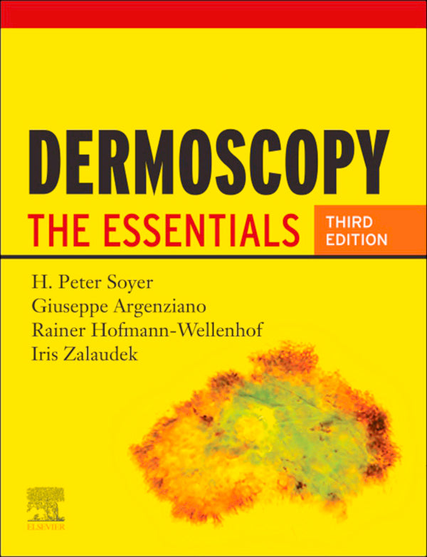 Dermoscopy E-Book (ebook)
