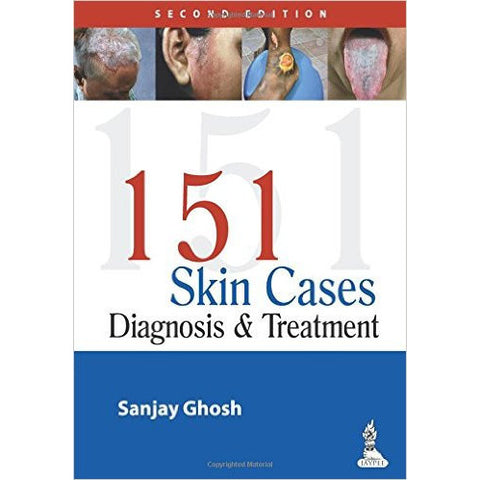 151 SKIN CASES DIAGNOSIS AND TREATMENT, 2/E -Ghosh-REVISION - 26/01-jayppe-UNIVERSAL BOOKS