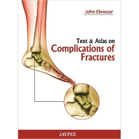 TEXT & ATLAS ON COMPLICATIONS OF FRACTURES -Ebnezar-UB-2017-jayppe-UNIVERSAL BOOKS