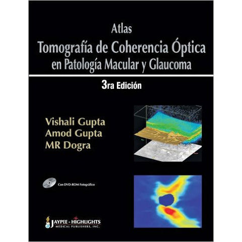 ATLAS TOMOGRAFIA DE COHERENCIA OPTICA EN PATOLOGIA MACULAR Y GLAUCOMA /3ra.EDICION -Gupta, Gupta, Dogra-REVISION - 23/01-jayppe-UNIVERSAL BOOKS