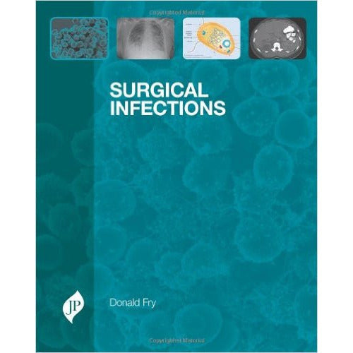 SURGICAL INFECTIONS -Fry-jayppe-UNIVERSAL BOOKS