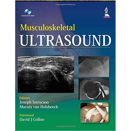 Musculoskeletal Ultrasound-UB-2017-jayppe-UNIVERSAL BOOKS