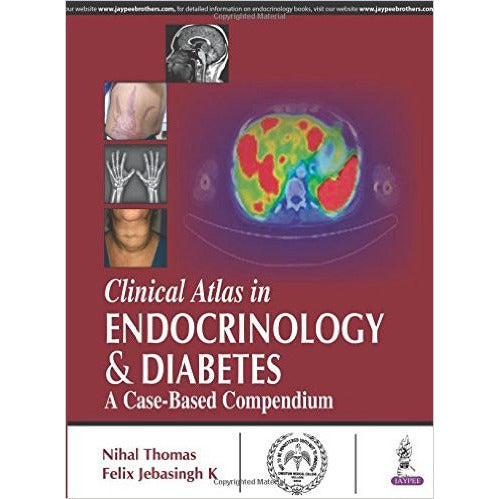 Clinical Atlas in Endocrinology and Diabetes: A Case-Based Compendium-UB-2017-jayppe-UNIVERSAL BOOKS