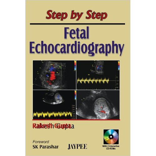 STEP BY STEP ECHOCARDIOGRAPHY WITH 2 INST. CD-ROMS -Gupta-UB-2017-jayppe-UNIVERSAL BOOKS