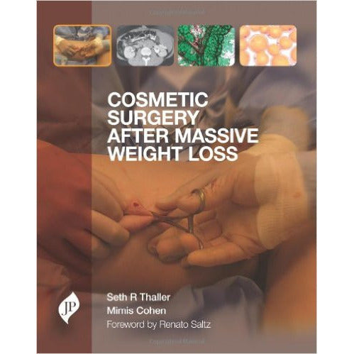 COSMETIC SURGERY AFTER MASSIVE WEIGHT LOSS -Thaller-jayppe-UNIVERSAL BOOKS