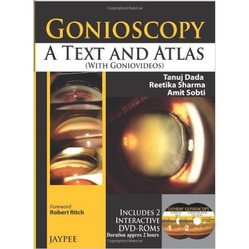 GONIOSCOPY: A TEXT AND ATLAS (WITH GONIOVIDEOS)-Dada-jayppe-UNIVERSAL BOOKS
