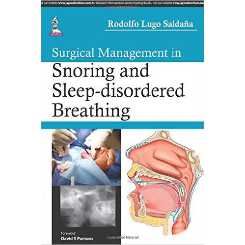 SURGICAL MANAGEMENT IN SNORING AND SLEEP-DISORDERED BREATHING- Saldana-REVISION - 26/01-jayppe-UNIVERSAL BOOKS