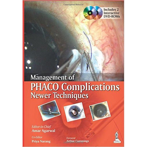 MANAGEMENT OF PHACO COMPLICATIONS NEWER TECHNIQUES INCLUDES 2 INT.DVD-ROM -Agarwal-jayppe-UNIVERSAL BOOKS