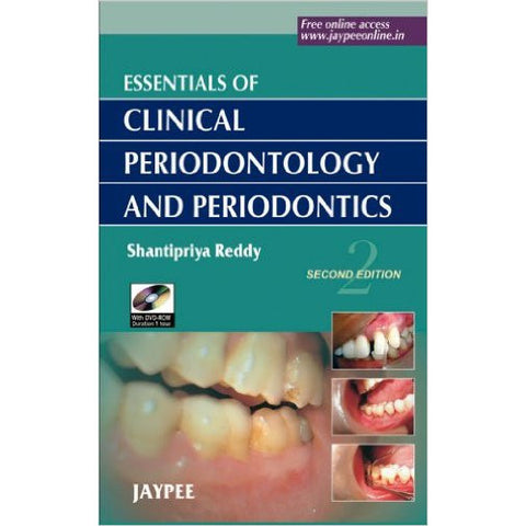 CLINICAL PERIODONTOLOGY AND PERIODONTICS-REVISION - 24/01-jayppe-UNIVERSAL BOOKS