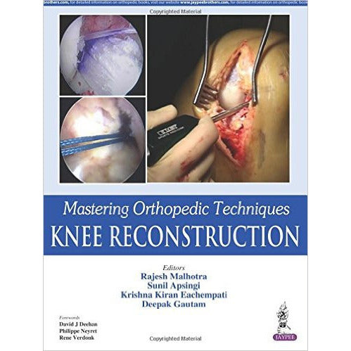 Mastering Orthopedic Techniques: Knee Reconstruction-UB-2017-jayppe-UNIVERSAL BOOKS