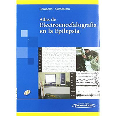Atlas de Electroencefalografia en Epilepsia. Incluye DVD-panamericana-UNIVERSAL BOOKS