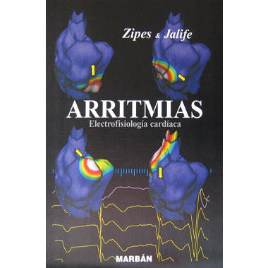 ARRITMIAS Electrofisiologia Cardiaca - Zipes & Jalife-REVISION - 20/01-MARBAN-UNIVERSAL BOOKS