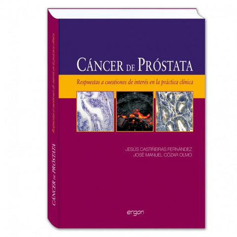 Cancer de prostata - Respuestas a cuestiones de interes en la practica clinica-ergon-UNIVERSAL BOOKS