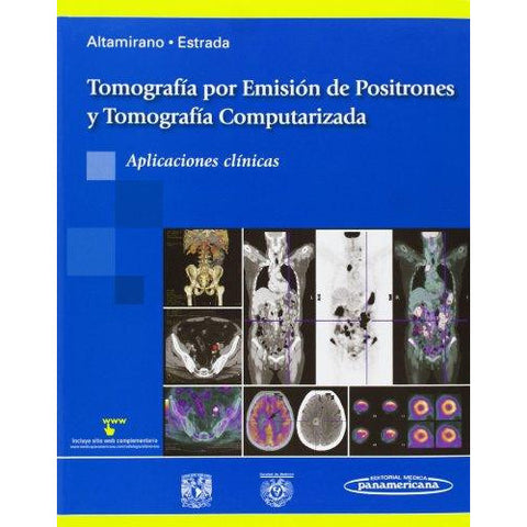 Tomografia por Emision de Positrones y Tomografia Computarizada. Aplicaciones clinicas-REVISION - 25/01-panamericana-UNIVERSAL BOOKS