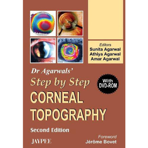 Dr Agarwals’ Step by Step Corneal Topography-REVISION - 26/01-jayppe-UNIVERSAL BOOKS