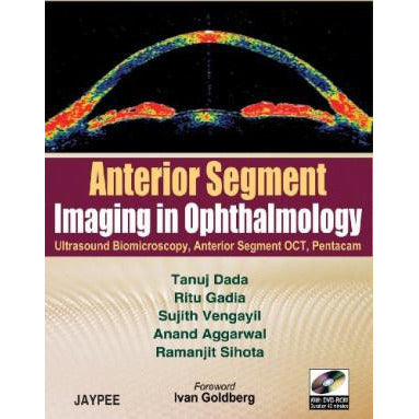 ANTERIOR SEGMENT IMAGING IN OPHTHALMOLOGY WITH DVD-ROM-REVISION - 20/01-jayppe-UNIVERSAL BOOKS