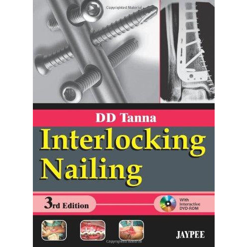 INTERLOCKING NAILING (R) WITH INT. DVD-ROM -Tanna-UB-2017-jayppe-UNIVERSAL BOOKS