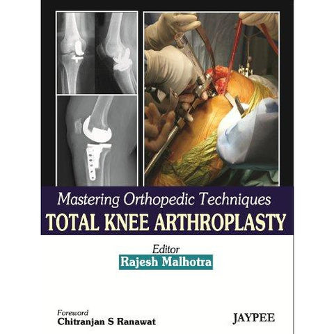 Mastering Orthopedic Techniques Total knee Arthroplasty-REVISION - 25/01-jayppe-UNIVERSAL BOOKS