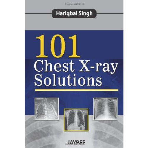 101 Chest X-ray Solutions - Hariqbal Singh-UB-2017-jayppe-UNIVERSAL BOOKS