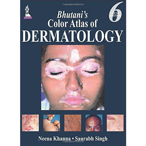 Bhutani’s Color Atlas of Dermatology-REVISION - 23/01-jayppe-UNIVERSAL BOOKS