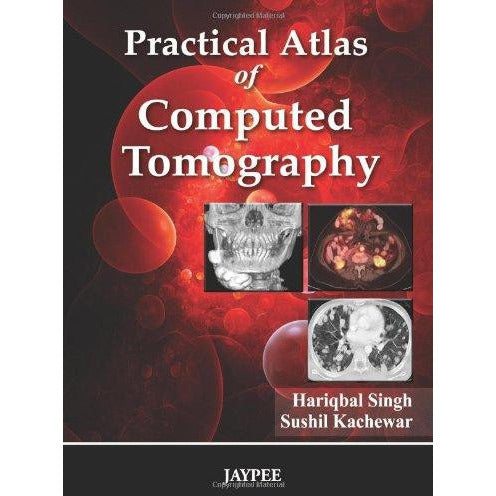 PRACTICAL ATLAS OF COMPUTED TOMOGRAPHY -Singh-REVISION - 27/01-jayppe-UNIVERSAL BOOKS