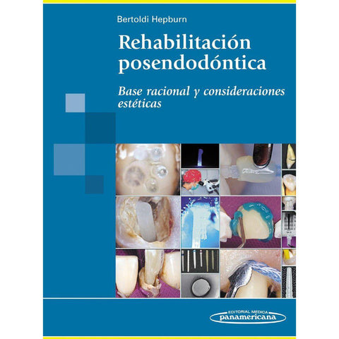 Rehabilitacion Posendodontica. Base racional y consideraciones esteticas-REVISION - 27/01-panamericana-UNIVERSAL BOOKS