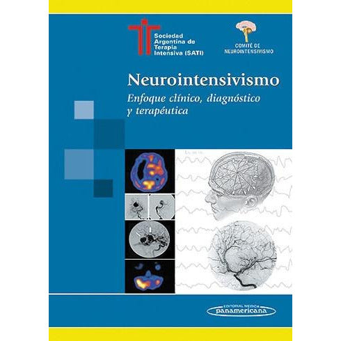Neurointensivismo. Enfoque cl¡nico, diagn¢stico y terap‚utica-30ENE-panamericana-UNIVERSAL BOOKS