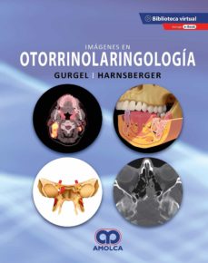 Imágenes en Otorrinolaringología Novedades 2020