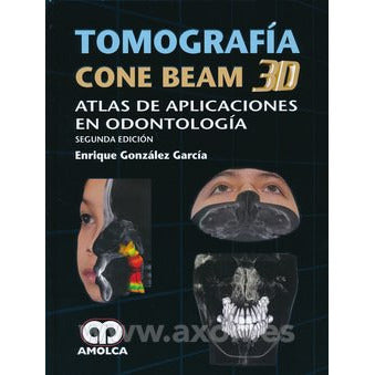 TOMOGRAFIA CONE BEAM 3D: ATLAS DE APLICACIONES EN ODONTOLOGIA (2ª ED.)-REVISION - 25/01-AMOLCA-UNIVERSAL BOOKS