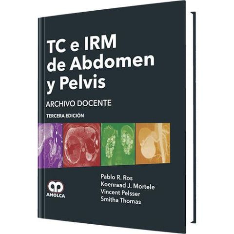 TC E IRM DE ABDOMEN Y PELVIS-REVISION - 27/01-AMOLCA-UNIVERSAL BOOKS