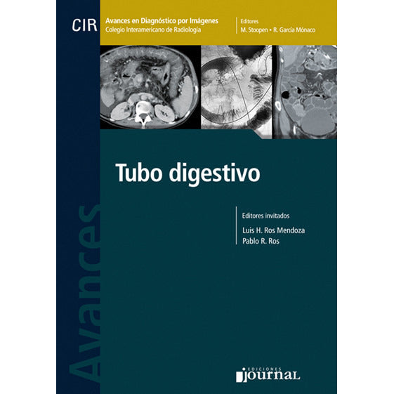 Tubo Digestivo - Avances en Diagnostico por Imagenes - M. Stoopen-REVISION - 25/01-UNIVERSAL BOOKS-UNIVERSAL BOOKS