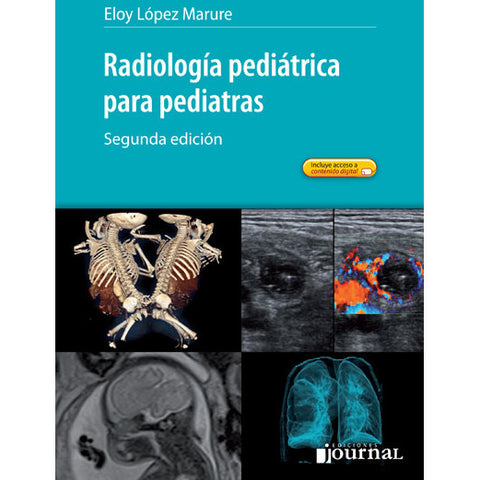 Radiología pediátrica para pediatras - 2ª Ed.-REVISION - 27/01-UNIVERSAL BOOKS-UNIVERSAL BOOKS