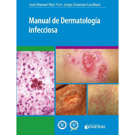 MANUAL DE DERMATOLOGIA INFECCIOSA - JOURNAL-UB-2017-UNIVERSAL BOOKS-UNIVERSAL BOOKS