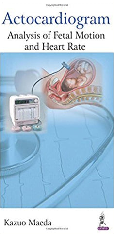 Actocardiogram Analysis of fetal motion and heart Rate-ub-jayppe-UNIVERSAL BOOKS