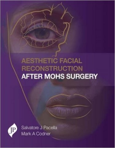 Aesthetic Facial Reconstruction after Mohs Surgery-UNIVERSAL 26.04-UNIVERSAL BOOKS-UNIVERSAL BOOKS
