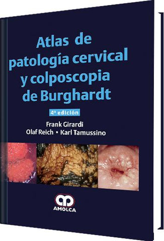 Atlas de Patología Cervical y Colposcopia de Burghardt – Cuarta edición-UNIVERSAL BOOKS-UNIVERSAL BOOKS