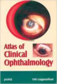 ATLAS OF CLINICAL OPHTHALMOLOGY -Loganathan-jayppe-UNIVERSAL BOOKS